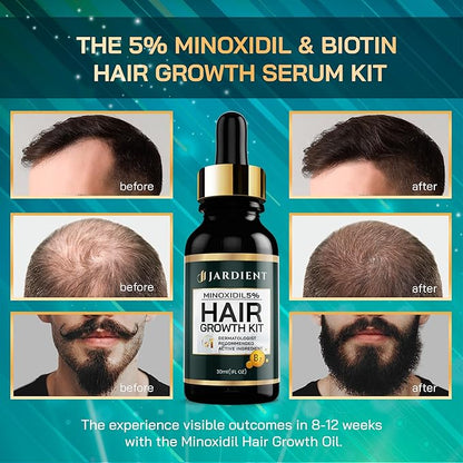 Minoxidil and Biotin Hair Growth Oil for Beards and Preventing Hair Thinning - 5% Minoxidil for Men and Women, 1 Fl Oz