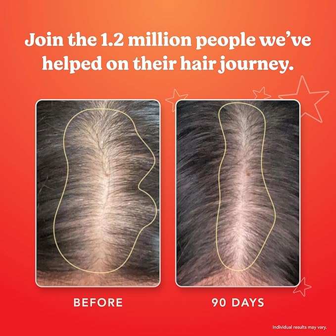 HAIRtamin Advanced Formula Hair Growth Supplement for Women & Men, Supports Stronger, Longer, Visibly Thicker Hair, With 5000 mcg Biotin, Vitamins & Antioxidants, 100% Vegan – 1 Month Supply