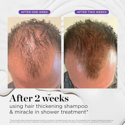 Dr. Groot Miracle in Shower Treatment, Korean Hair Care, 5 Seconds to Smooth Hair, Rosemary Oil for Healthier-Looking Hair, Hair Rinse, Moisturizing Hair Treatment, Kbeauty Scalp Revitalizing Solution