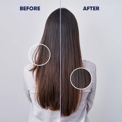 MOERIE Ultimate Hair Growth Serum for Natural Hair Regrowth & Thickening - Anti Thinning & Hair Loss Treatment for Women - Rapid Hair Growth Products - Scalp Oil Alternative - 1.69 fl oz / 50 ml