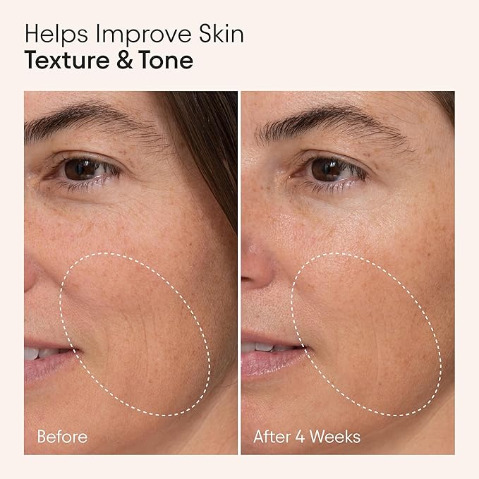 Alpyn Wild Nettle & Niacinamide Firming Serum | Visibly Smooth, Plump, & Moisturize | Reduce the Look of Fine Lines & Pores - For All Skin Types | 1 oz / 30 ml