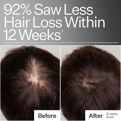 Act+Acre Cold Processed Thick + Full Hair System | Thicker, Fuller Looking Hair | Stem Cells, Caffeine, Pea Sprout | Strengthens, Hydrates, Volumizes | Vegan, Fragrance-Free, Color Safe | 3-Piece Set