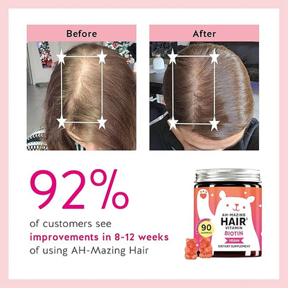 Biotin Gummies for Hair, Skin & Nails. 5,000 mcg High Potency Vegan Vitamins for Faster Hair Growth, Stronger Nails & Healthy Skin. with Vitamins C & E, 90 Gummies