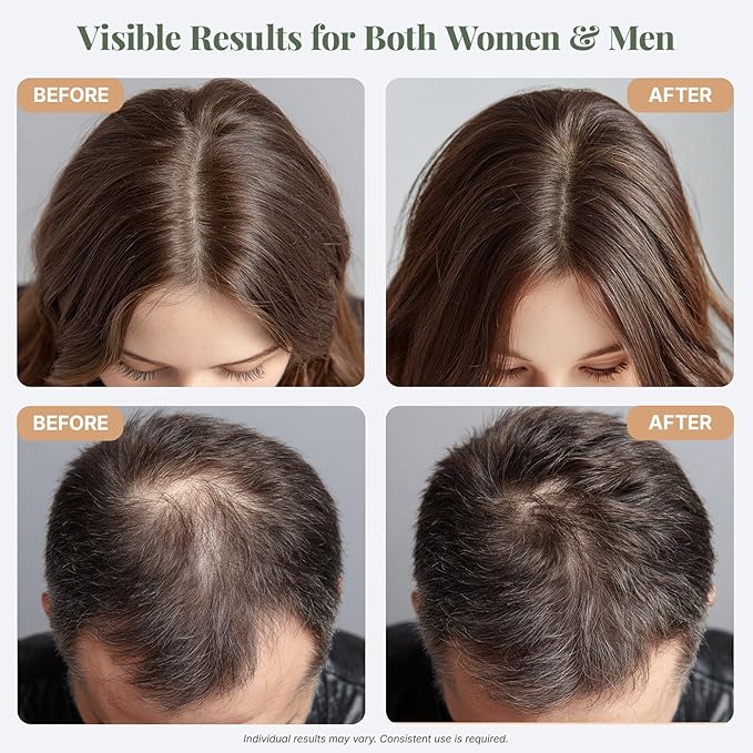 The ÉLIX USDA Organic Rosemary Oil for Hair Growth | Thickening Formula with Castor & Pumpkin Seed | for Hair Loss & Thinning | Made in USA | 4oz
