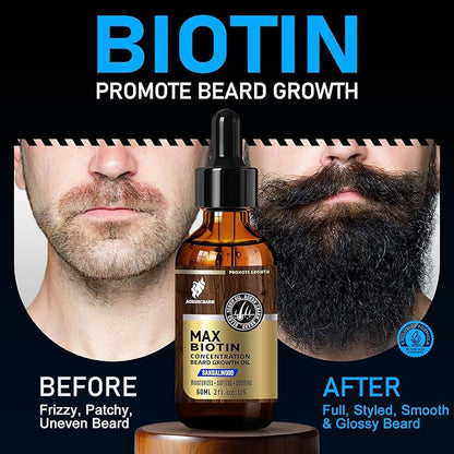 Biotin Beard Oil for Men – Sandalwood Scented Beard Growth Oil with Castor, Vitamin B5 & Grape Seed – Soften & Tame Coarse Beards – Natural Grooming Gift for Him – 2 oz
