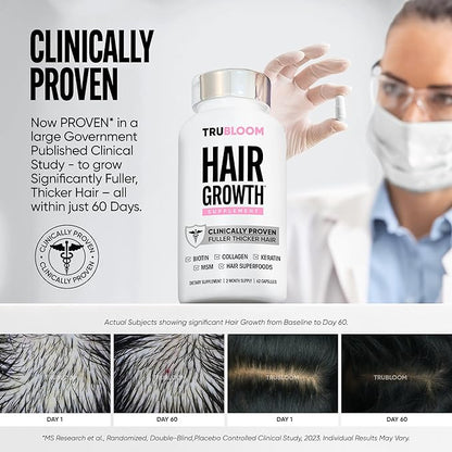 Tru Bloom Hair Growth Vitamins - 2 Month Supply. Clinically Proven to Grow Fuller, Thicker Hair. Drug-Free with Biotin, Collagen, Keratin, MSM, Zinc, D3 + Hair Superfoods