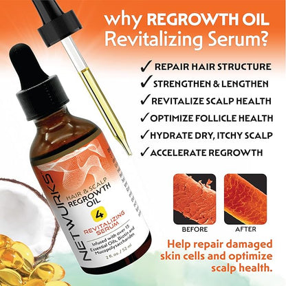 Hair & Scalp Regrowth Oil, Pure Rosemary, Coconut Oil, Biotin & Mucopolysaccharides, (polysaccharide/sugar polymer), Repairs & Promotes Hair Growth, Revitalizing Serum, 2 oz