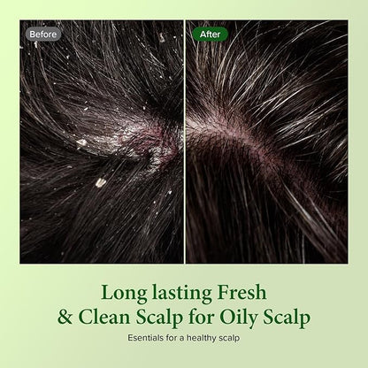 Kundal Tea Tree & Macadamia Deep Cleansing Shampoo - Korean Hair Care, Scalp Care, Tea Tree extract, For All hair Types 10.14fl oz each (Pack of 2) (Baby Powder)