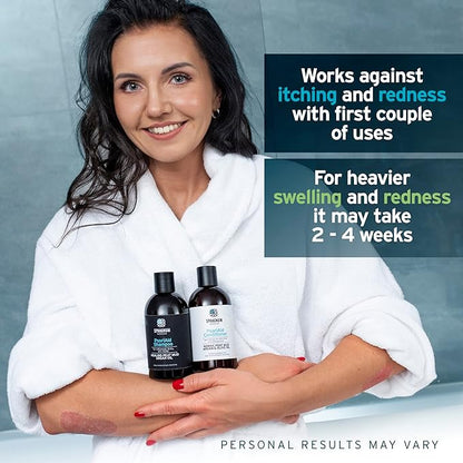 Natural Psoriasis Shampoo - Peat Mud & Tea Tree Oil Therapy for Itchy and Red Scalp Treatment. No Coal Tar. 8.45 Oz