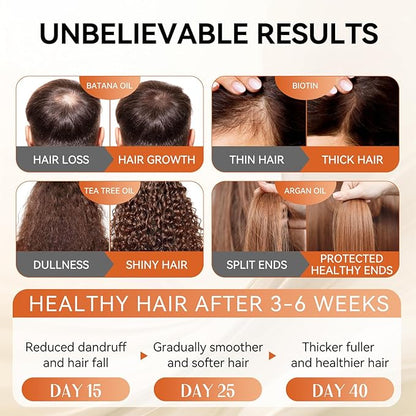 Castor Oil Shampoo and Conditioner Set for Hair Growth Strengthen and Cleanse Shampoo for Thin Hair Restore Damaged Hair Sulfate Free for Men & Women,16.9 FL Oz