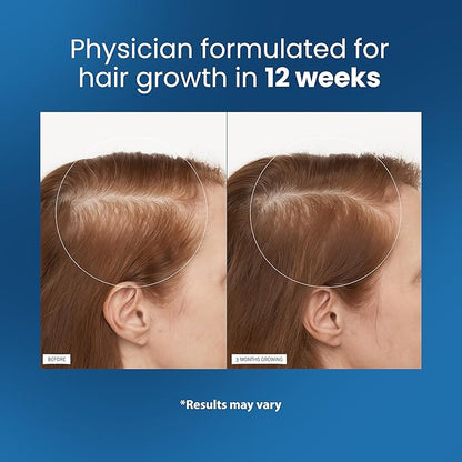 Be Bodywise Rosemary Hair Growth Serum Roll On 25 ml – 3% Rosemary, 3% Redensyl & 2% Anagain | DHT-Blocking Scalp Serum Boosts Oxygen Flow, Reduces Hair Fall | Paraben/Sulfate-Free | Women & Men