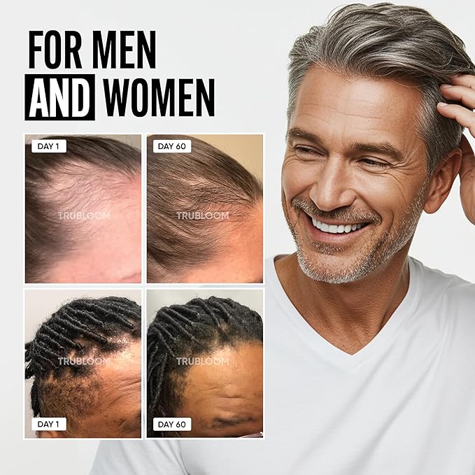 Tru Bloom Hair Growth Vitamins - 2 Month Supply. Clinically Proven to Grow Fuller, Thicker Hair. Drug-Free with Biotin, Collagen, Keratin, MSM, Zinc, D3 + Hair Superfoods