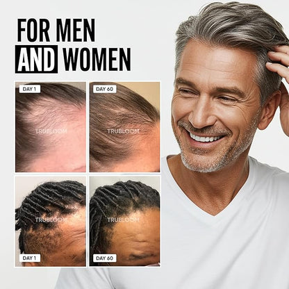 Tru Bloom Hair Growth Vitamins - 2 Month Supply. Clinically Proven to Grow Fuller, Thicker Hair. Drug-Free with Biotin, Collagen, Keratin, MSM, Zinc, D3 + Hair Superfoods