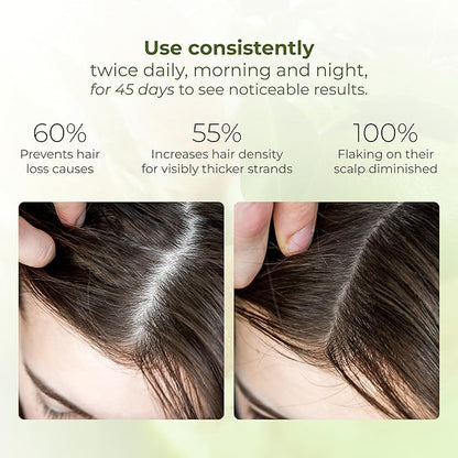 Cocoon Pomelo Oil Hair Tonic. 100% Vegan Scalp Serum Treatment for Thinning, Damaged & Breakage Hair | Soften, Reduce Hair Loss & Promote Hair Growth (4.73 fl oz Each) (3 Boxes)