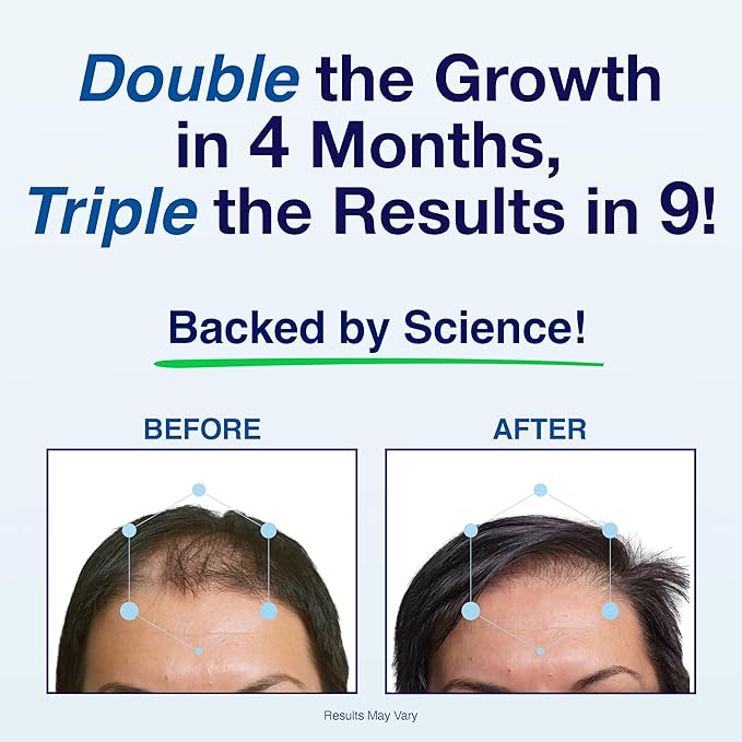 Patented Hair Growth Vitamins for Women & Men | Clinically Proven Hair Loss Supplement for Visibly Thicker Fuller Hair | Dr. Recommended Hair Vitamins for Hair Loss and Thinning | 2 Month Supply