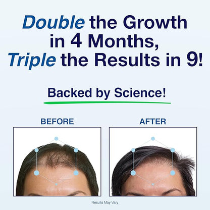 Patented Hair Growth Vitamins for Women & Men | Clinically Proven Hair Loss Supplement for Visibly Thicker Fuller Hair | Dr. Recommended Hair Vitamins for Hair Loss and Thinning | 2 Month Supply