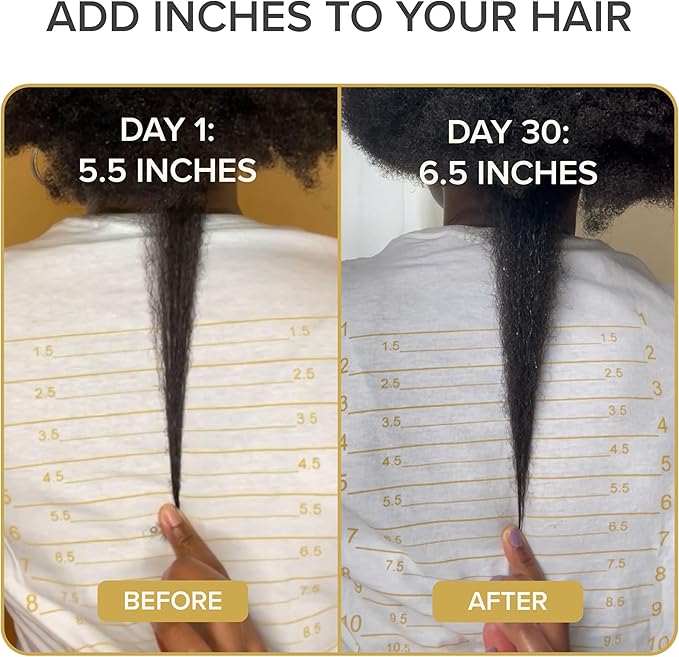 Iconic Natural Hair Vitamins for Fast Hair Growth, Pure Hair Supplements Formulated with Vitamins to Promote Thicker, Stronger Hair - Vegan Hair Care for Hair Loss - (60 Capsules(Pack of 1))