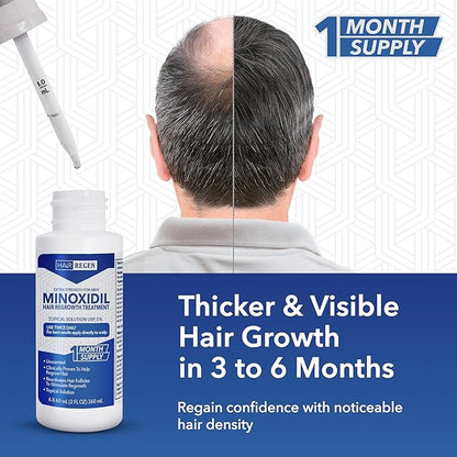 Advanced 5% Minoxidil For Men Hair Regrowth Treatment for Thinning Hair - Hair Loss for Men - 1 Month Supply, Minoxidil Topical Solution So Thicker Fuller Hair Keeps Growing Amazing Results