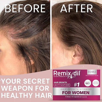 Hair Growth Vitamins for Visibly Thicker & Stronger Hair - Supplements for Hair Loss Treatment and Thinning Hair in Women