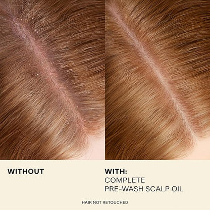 JVN Pre-Wash Scalp Oil & Hair Treatment Oil, Pre Shampoo Dry Scalp Treatment, Scalp Cleansing Oil for All Hair Types, Sulfate Free (1.7 Fl Oz)