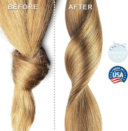 MARULA Oil Cold Pressed Unrefined | 100% Natural Available in Bulk | Carrier for Essential Oils, Face, Skin, Hair Moisturizer, Soap Making | Sizes 2OZ to 7 LBS | (32 OZ)